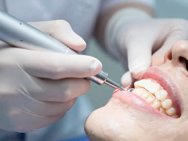 Jaká je bolestivost kyretáže zubů? Přehled bolesti, anestezie a pooperační péče